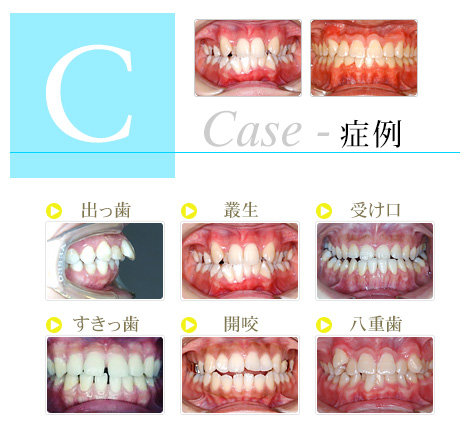 case 症例集 あなたのお悩みは？