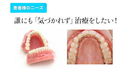 誰にも「気づかれず」治療をしたい！