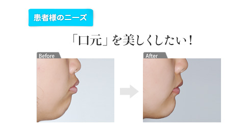 「口元」を美しくしたい！